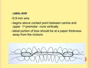 74
LABIAL BOW
-0.9 mm wire
- begins above contact point between canine and
upper 1st premolar –runs vertically
- labial portion of bow should be at a paper thickness
away from the incisors
 