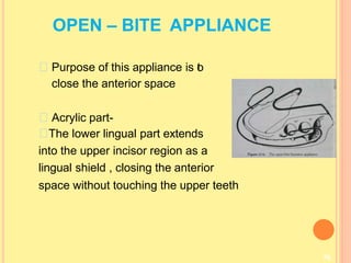OPEN – BITE APPLIANCE
76
Purpose of this appliance is t
o
close the anterior space
Acrylic part-
The lower lingual part extends
into the upper incisor region as a
lingual shield , closing the anterior
space without touching the upper teeth
 