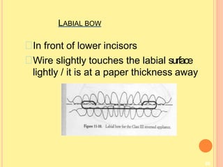 LABIAL BOW
80
In front of lower incisors
Wire slightly touches the labial surface
lightly / it is at a paper thickness away
 