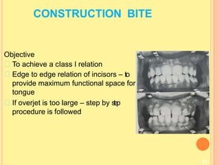 CONSTRUCTION BITE
81
Objective
To achieve a cIass I relation
Edge to edge relation of incisors – to
provide maximum functional space for
tongue
If overjet is too large – step by s
t
e
p
procedure is followed
 