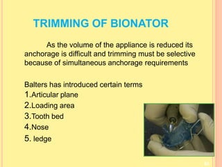 TRIMMING OF BIONATOR
83
As the volume of the appliance is reduced its
anchorage is difficult and trimming must be selective
because of simultaneous anchorage requirements
Balters has introduced certain terms
1.Articular plane
2.Loading area
3.Tooth bed
4.Nose
5. ledge
 