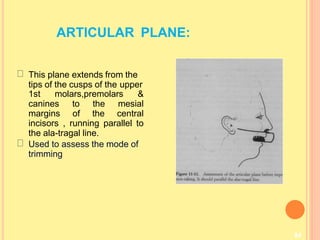 ARTICULAR PLANE:
84
This plane extends from the
tips of the cusps of the upper
1st molars,premolars &
canines to the mesial
margins of the central
incisors , running parallel to
the ala-tragal line.
Used to assess the mode of
trimming
 