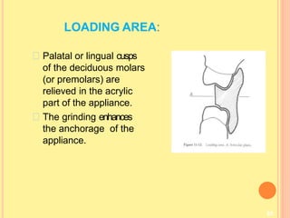 LOADING AREA:
85
Palatal or lingual cusps
of the deciduous molars
(or premolars) are
relieved in the acrylic
part of the appliance.
The grinding enhances
the anchorage of the
appliance.
 