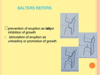 BALTERS REFERS
89
prevention of eruption as l
o
a
d
i
n
gor
inhibition of growth
stimulation of eruption as
unloading or promotion of growth
 