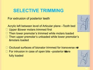 SELECTIVE TRIMMING
91
For extrusion of posterior teeth
Acrylic left between level of Articular plane –Tooth bed
Upper &lower molars trimmed first
Then lower premolar’s trimmed while molars loaded
Then upper premolar’s unloaded while lower premolar’s
&molars loaded
Occlusal surfaces of bionator trimmed for transverse m
o
v
t
For intrusion in case of open bite –posterior t
e
e
t
h
are
fully loaded
 