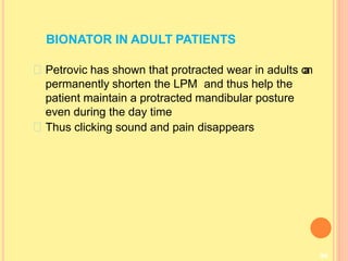 BIONATOR IN ADULT PATIENTS
94
Petrovic has shown that protracted wear in adults c
a
n
permanently shorten the LPM and thus help the
patient maintain a protracted mandibular posture
even during the day time
Thus clicking sound and pain disappears
 