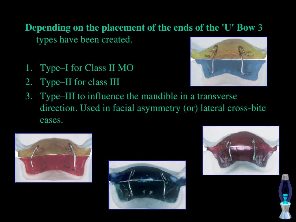 Activator and its modifications