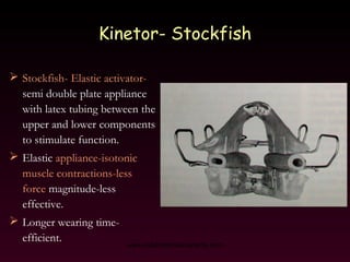 Kinetor de Stockfish 1