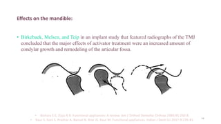 Effects on the mandible:
• Birkebaek, Melsen, and Teip in an implant study that featured radiographs of the TMJ
concluded that the major effects of activator treatment were an increased amount of
condylar growth and remodeling of the articular fossa.
• Bishara S E, Ziaja R R. Functional appliances: A review. Am J Orthod Dentofac Orthop.1989;95:250-8.
• Kaur S, Soni S, Prashar A, Bansal N, Brar JS, Kaur M. Functional appliances. Indian J Dent Sci 2017;9:276-81. 14
 