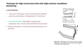Technique for High construction bite with slight anterior mandibular
positioning
V-ACTIVATORS
• Activator with large vertical opening and minimal
anterior positioning is designated as V activator.
• Construction bite: Mandible is positioned
anteriorly only 3-5mm ahead of habitual occlusion.
• Vertical opening 4 to 6mm beyond the postural rest
position.
48
 