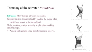 Trimming of the activator: Vertical Plane
Intrusion:- Only limited intrusion is possible.
Incisor intrusion: brought about by loading the incisal edge.
• Labial bow placed in the incisal third.
Molar intrusion brought about by acrylic plate touching
only the cusps.
• Acrylic plate ground away from fissures and grooves.
57
 