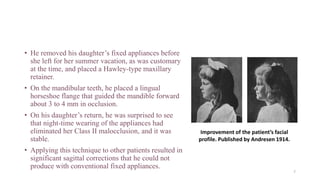 • He removed his daughter’s fixed appliances before
she left for her summer vacation, as was customary
at the time, and placed a Hawley-type maxillary
retainer.
• On the mandibular teeth, he placed a lingual
horseshoe flange that guided the mandible forward
about 3 to 4 mm in occlusion.
• On his daughter’s return, he was surprised to see
that night-time wearing of the appliances had
eliminated her Class II malocclusion, and it was
stable.
• Applying this technique to other patients resulted in
significant sagittal corrections that he could not
produce with conventional fixed appliances.
Improvement of the patient’s facial
profile. Published by Andresen 1914.
7
 