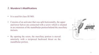 2. Wunderer's Modifications
• It is used for class III MO.
• Consists of an activator that was split horizontally, the upper
and lower halves are connected with a screw which is situated
in an extension of the mandibular portion behind the maxillary
incisors.
• By opening the screw, the maxillary portion is moved
anteriorly with a reciprocal backward thrust on the
mandibular portion.
74
 