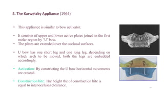 5. The Karwetzky Appliance (1964)
• This appliance is similar to bow activator.
• It consists of upper and lower active plates joined in the first
molar region by ‘U’ bow.
• The plates are extended over the occlusal surfaces.
• U bow has one short leg and one long leg, depending on
which arch to be moved, both the legs are embedded
accordingly.
• Activation: By constricting the U bow horizontal movements
are created.
• Construction bite: The height the of construction bite is
equal to inter occlusal clearance.
77
 