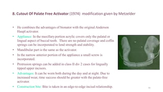 Activator- A Functional Appliance. pptx | PPTX