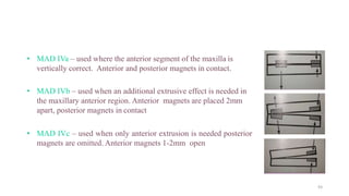 • MAD IVa – used where the anterior segment of the maxilla is
vertically correct. Anterior and posterior magnets in contact.
• MAD IVb – used when an additional extrusive effect is needed in
the maxillary anterior region. Anterior magnets are placed 2mm
apart, posterior magnets in contact
• MAD IVc – used when only anterior extrusion is needed posterior
magnets are omitted. Anterior magnets 1-2mm open
93
 