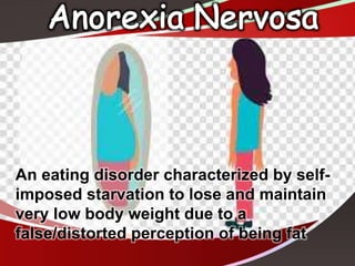 An eating disorder characterized by self-
imposed starvation to lose and maintain
very low body weight due to a
false/distorted perception of being fat
 