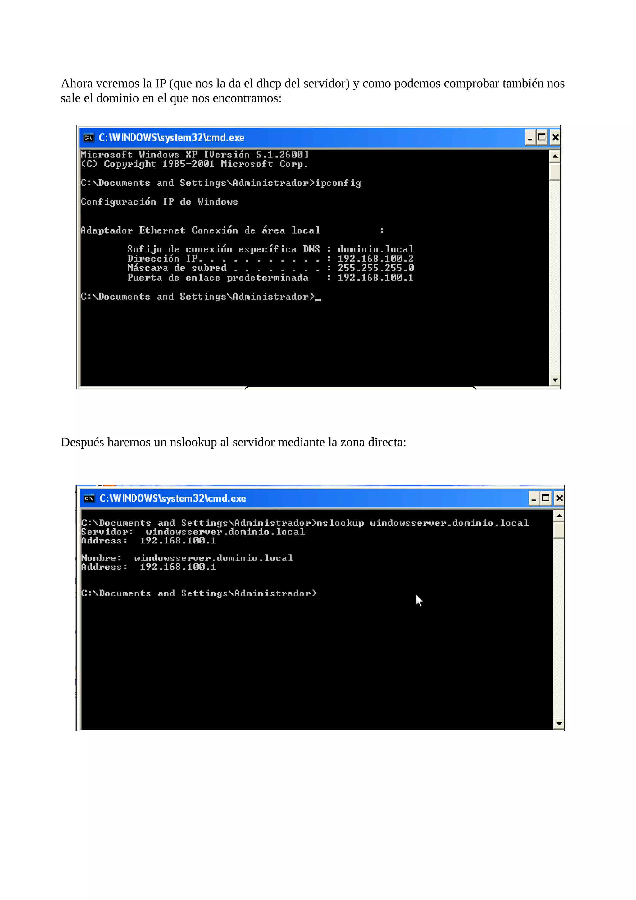 Ahora veremos la IP (que nos la da el dhcp del servidor) y como podemos comprobar también nos
sale el dominio en el que nos encontramos:




Después haremos un nslookup al servidor mediante la zona directa:
 