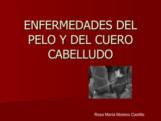ENFERMEDADES DEL PELO Y DEL CUERO CABELLUDO Rosa María Moreno Castillo 