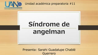 Síndrome de
angelman
Presenta: Sarahi Guadalupe Chablé
Guerrero
Unidad académica preparatoria #11
 