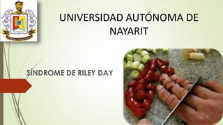 UNIVERSIDAD AUTÓNOMA DE
NAYARIT
SÍNDROME DE RILEY DAY
 
