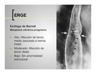 ERGE
Esófago de Barrett
Metaplasia cilíndrica progresiva
 

 

 

Alto: Afección de tercio
medio asociada a hernia
hiatal.
Moderado: Afección de
tercio distal.
Bajo: Sin anormalidad
estructural

 