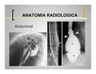 ANATOMIA RADIOLOGICA
Abdominal
A

B

 