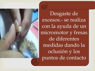 Desgaste de
excesos.- se realiza
con la ayuda de un
micromotor y fresas
de diferentes
medidas dando la
oclusión y los
puntos de contacto

 