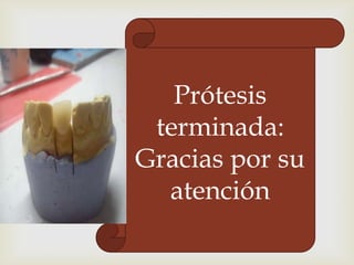 Prótesis
terminada:
Gracias por su
atención

 