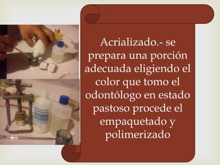 Acrializado.- se
prepara una porción
adecuada eligiendo el
color que tomo el
odontólogo en estado
pastoso procede el
empaquetado y
polimerizado

 
