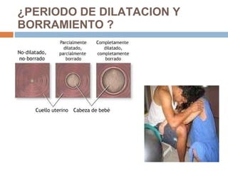 ¿PERIODO DE DILATACION Y BORRAMIENTO ? 