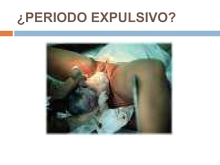 ¿PERIODO EXPULSIVO? 