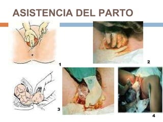 ASISTENCIA DEL PARTO 1 2 3 4 