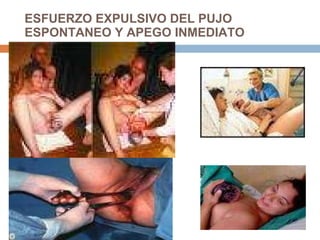 ESFUERZO EXPULSIVO DEL PUJO ESPONTANEO Y APEGO INMEDIATO 