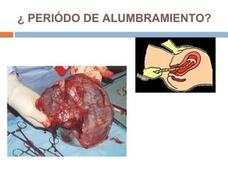 ¿ PERIÓDO DE ALUMBRAMIENTO? 