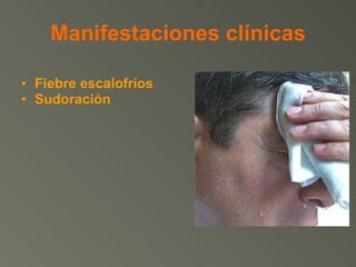 Manifestaciones clínicas Fiebre escalofríos  Sudoración  