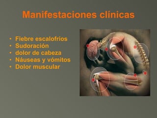 Manifestaciones clínicas Fiebre escalofríos  Sudoración  dolor de cabeza  Náuseas y vómitos  Dolor muscular 