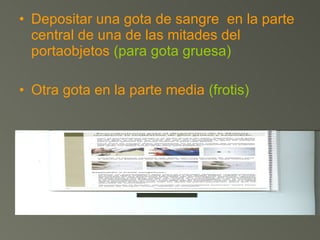 Depositar una gota de sangre  en la parte central de una de las mitades del portaobjetos  (para gota gruesa) Otra gota en la parte media  (frotis) 