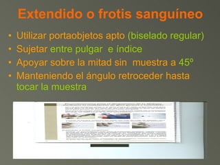 Extendido o frotis sanguíneo Utilizar portaobjetos apto  (biselado regular) Sujetar  entre pulgar  e índice Apoyar sobre la mitad sin  muestra a  45º Manteniendo el ángulo retroceder hasta  tocar la muestra 