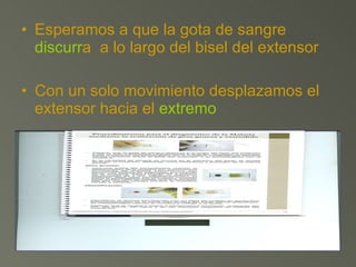 Esperamos a que la gota de sangre  discurr a  a lo largo del bisel del extensor Con un solo movimiento desplazamos el extensor hacia el  extremo 
