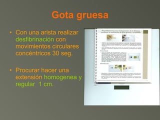Gota gruesa Con una arista realizar  desfibrinación  con movimientos circulares concéntricos 30 seg. Procurar hacer una extensión  homogenea y regular  1 cm . 