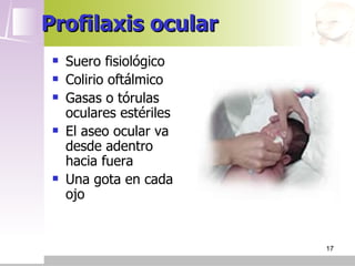 Profilaxis ocular
    Suero fisiológico
    Colirio oftálmico
    Gasas o tórulas
     oculares estériles
    El aseo ocular va
     desde adentro
     hacia fuera
    Una gota en cada
     ojo


                          17
 