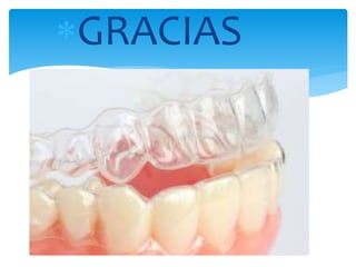 GRACIAS
 