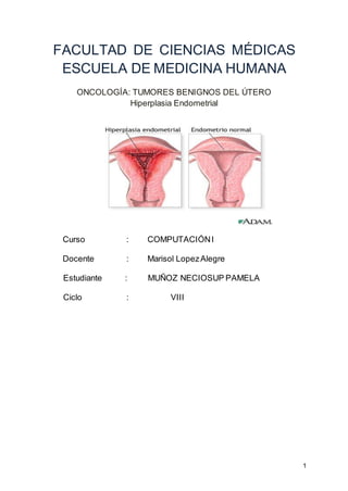 1
FACULTAD DE CIENCIAS MÉDICAS
ESCUELA DE MEDICINA HUMANA
ONCOLOGÍA: TUMORES BENIGNOS DEL ÚTERO
Hiperplasia Endometrial
Curso : COMPUTACIÓNI
Docente : Marisol LopezAlegre
Estudiante : MUÑOZ NECIOSUP PAMELA
Ciclo : VIII
 