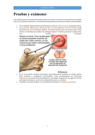 2
CANCER DE CERVIX
Pruebas y exámenes
Los cambios precancerososdel cuello uterino y el cáncer cervical no se pueden ver a simple
vista. Se necesitan exámenes y herramientasespecialespara descubrir talesenfermedades.
 Una citología vaginal detecta precánceres y cáncer, pero no es un diagnóstico final.
 La prueba de ADN para la detección del virus del papiloma humano (VPH) puede
hacerse junto con la citología vaginal. O puede hacerse una vez que la mujer haya
tenido un resultado anormal en la citología vaginal. También puede ser usada como
una prueba principal.
 Si se encuentran cambios anormales, generalmente se examina el cuello uterino
bajo aumento o ampliación microscópica. Este procedimiento se denomina
colposcopia. Durante este procedimiento, se extraen fragmentos de tejido en forma
quirúrgica (biopsia) y se envían al laboratorio para su análisis.
 También se puede realizar un procedimiento llamado conización quirúrgica.
 
