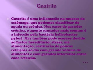 Gastrite<br />Gastrite é uma inflamação na mucosa do estômago, que podemos classificar de aguda ou crónica. Nos casos de g...
