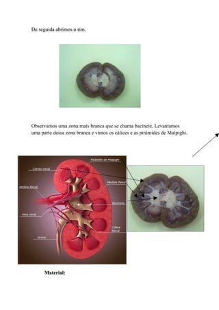 De seguida abrimos o rim.




Observamos uma zona mais branca que se chama bacinete. Levantamos
uma parte dessa zona branca e vimos os cálices e as pirâmides de Malpighi.




      Material:
 
