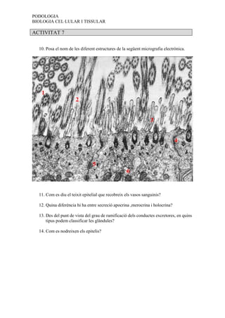 PODOLOGIA
BIOLOGIA CEL·LULAR I TISSULAR

ACTIVITAT 7


  10. Posa el nom de les diferent estructures de la següent micrografia electrònica.




   1
                      2


                                                                 3


                                                                               4


                                5
                                                   6


  11. Com es diu el teixit epitelial que recobreix els vasos sanguinis?

  12. Quina diferència hi ha entre secreció apocrina ,merocrina i holocrina?

  13. Des del punt de vista del grau de ramificació dels conductes excretores, en quins
      tipus podem classificar les glàndules?

  14. Com es nodreixen els epitelis?
 