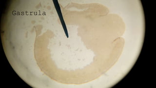 Gastrula