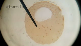 Blastula